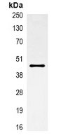 IP - Anti-Alpha-actin-1 Antibody AP61565